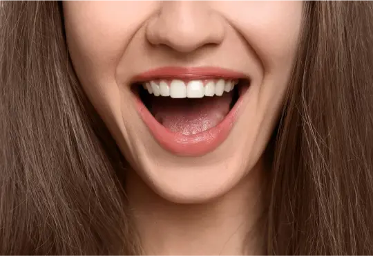 Smile design process